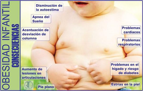 obesidadinfantil